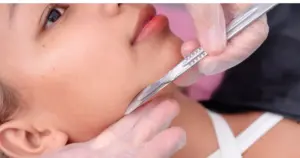 A close-up of a woman getting dermaplaning, with a gloved hand using a scalpel-like tool on her jawline in Edgewater, NJ